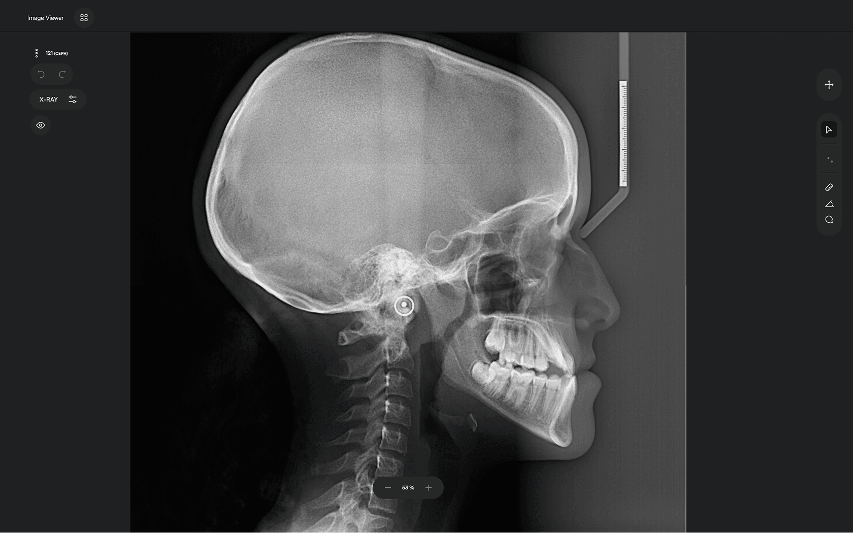 Clear Cephalometric X-ray