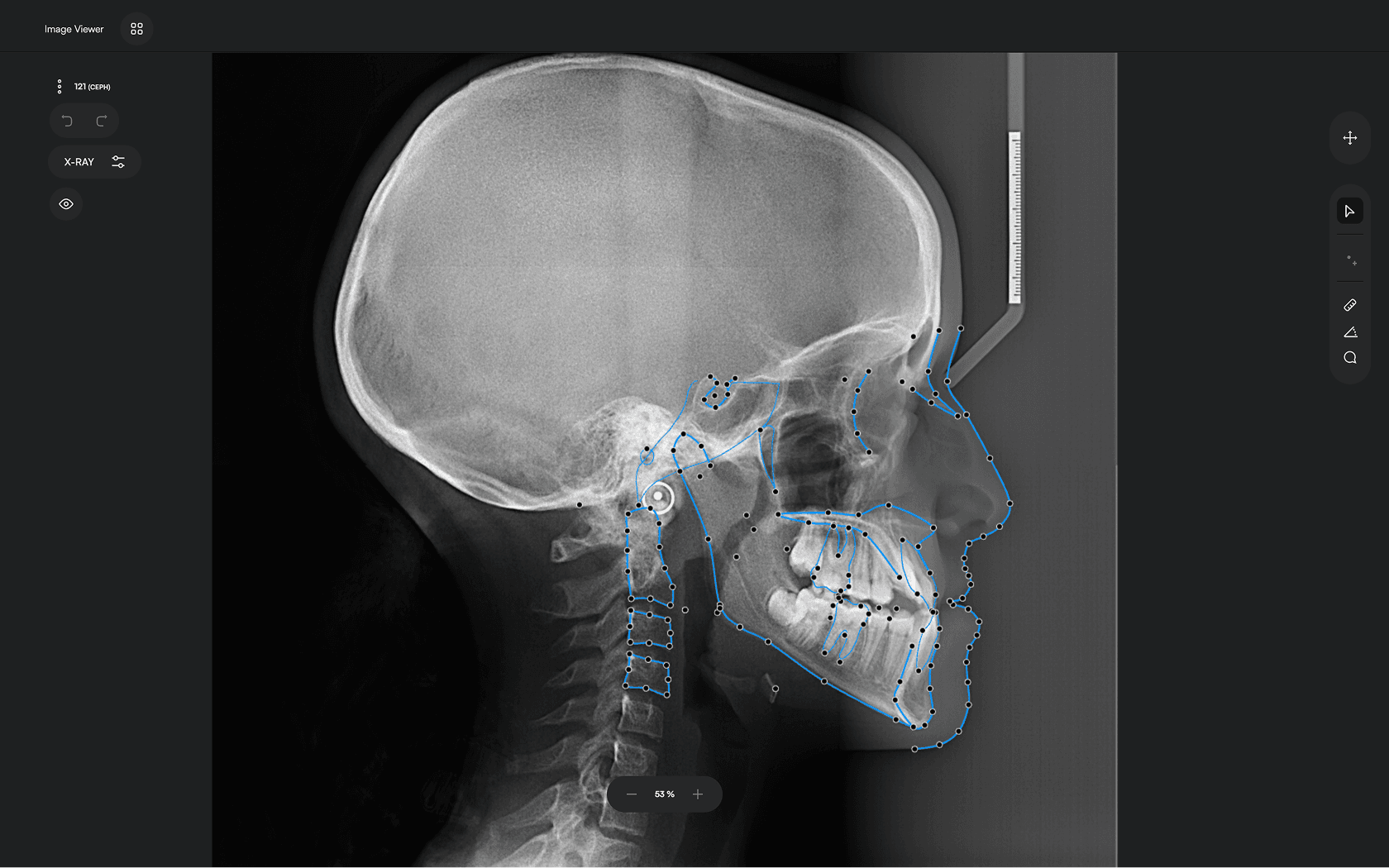 AI-annotated Cephalometric X-ray